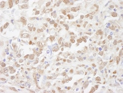 SUG1 Antibody, Novus Biologicals 0.1mL; Unlabeled:Antibodies, Polyclonal